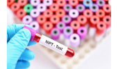 غربالگری جنین با تولید لوله های سل فریDNA ایرانی