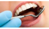 ضایعات دهانی ریسک ابتلا به سرطان را افزایش میدهند