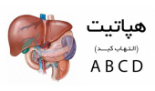 ۹۰ درصد مبتلایان به هپاتیت از بیماری خود خبر ندارند